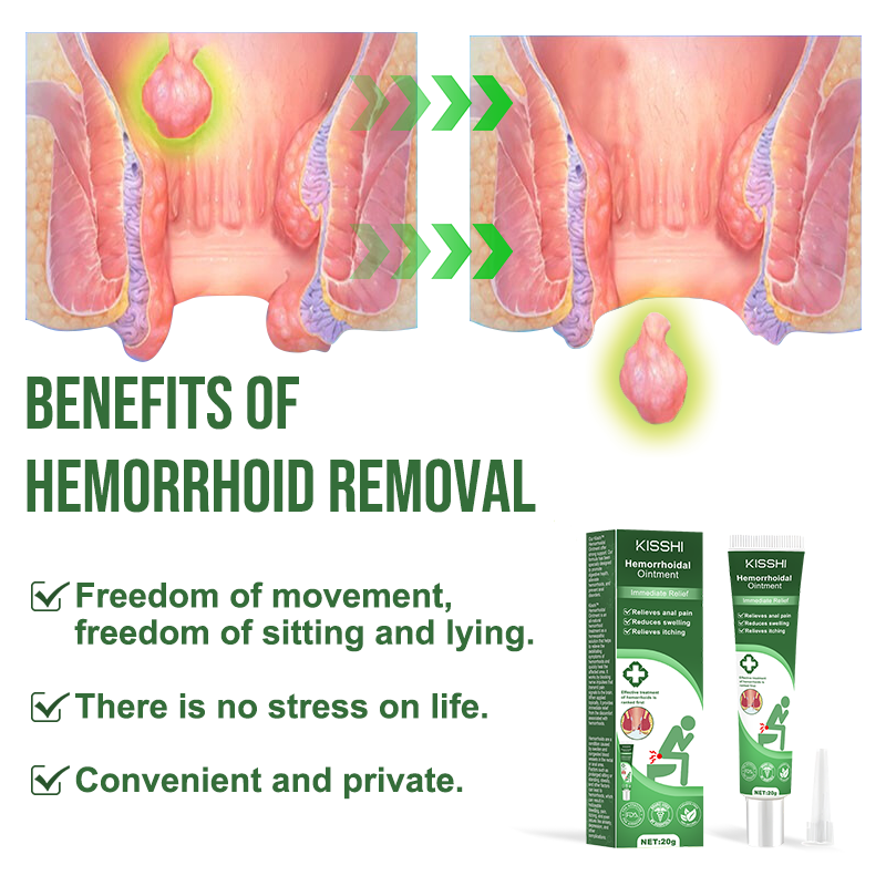 KISSHI™ Professional 2-Step Hemorrhoidal Treatment