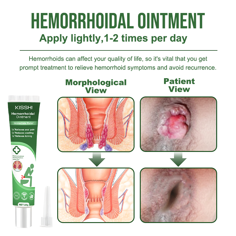 KISSHI™ Professional 2-Step Hemorrhoidal Treatment