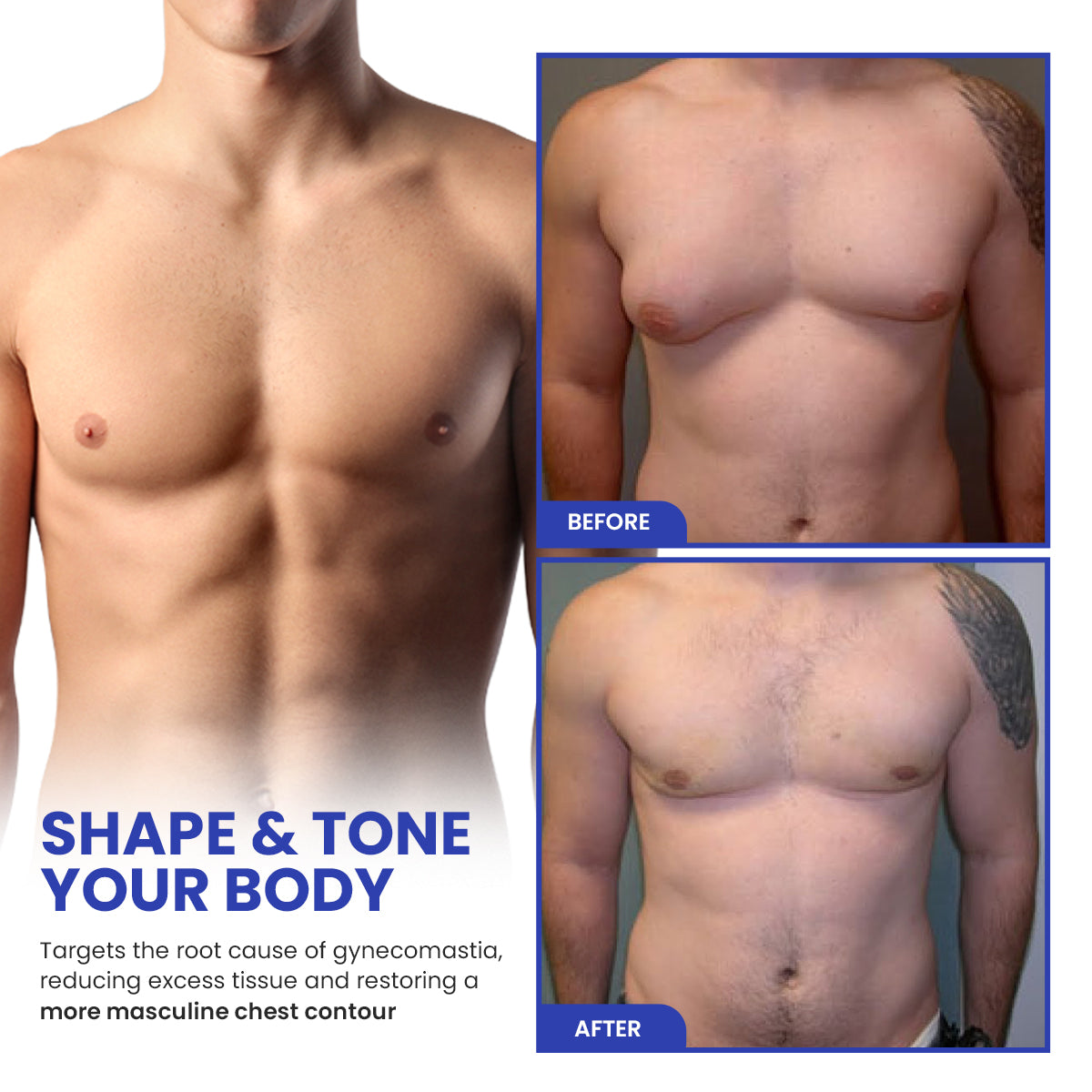 🔥KISSHI™ Gynecomastia Reduction Spray