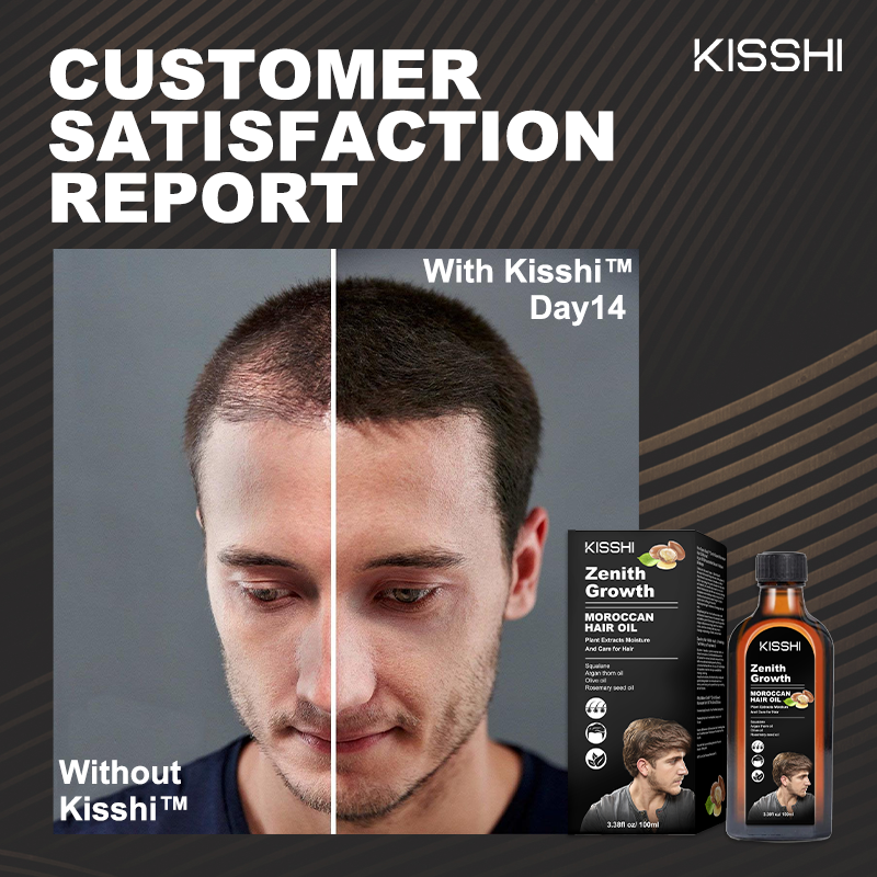 KISSHI™ ZenithGrowth Moroccan Hair Oil